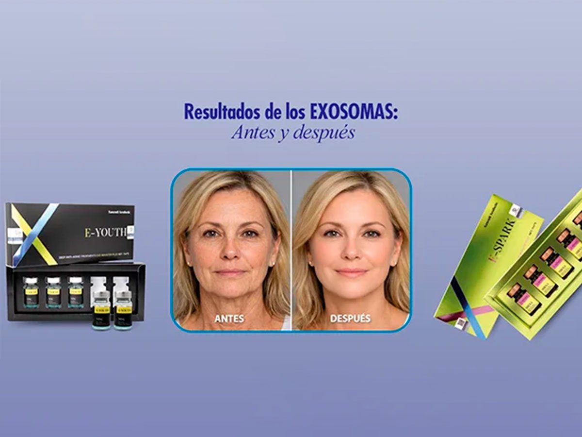 Exosomas PDRN aplicados en tratamiento facial regenerativo para rejuvenecimiento de la piel