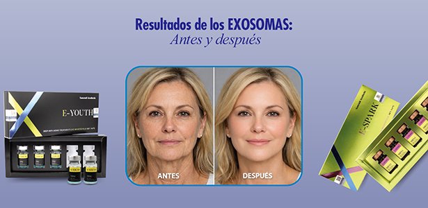 Exosomas PDRN: Qué son, beneficios, diferencias y cuándo elegirlos