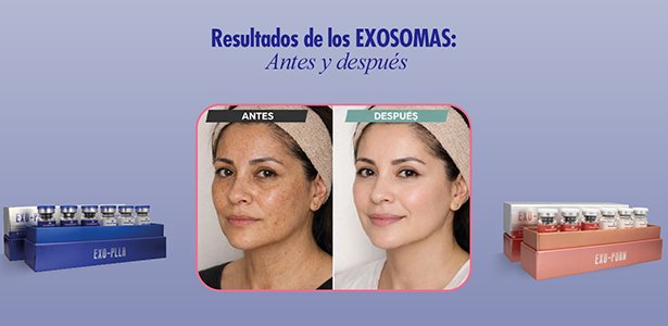 Resultados del tratamiento con exosomas faciales para rejuvenecimiento, mejora de firmeza y luminosidad de la piel